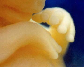 Foetus de 7 semaines